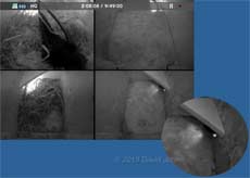 A Starling attempts unsuccessfully to enter Swift box (right) - 1 May